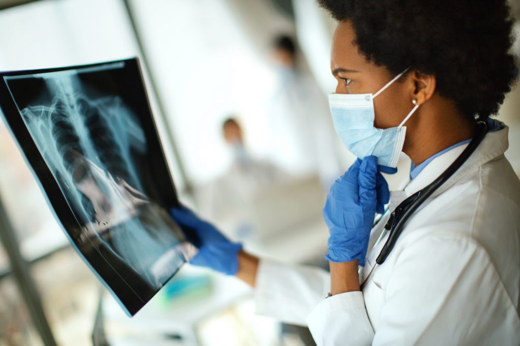 Oncologist examining x-ray of Black American's lungs