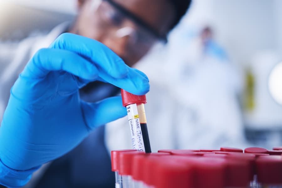 Laboratory technician placing patient’s blood sample on rack with other test tubes