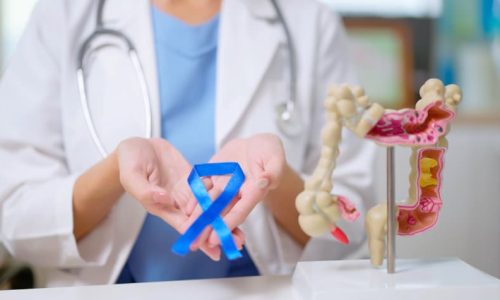 Doctor holding blue ribbon next to model of the colon