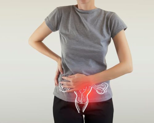 Female patient holding stomach in pain with graphical overlay illustration of uterus
